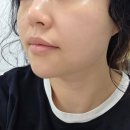 에이스 소프트 | 부천 원종동 에스테틱 ‘이쁨’ 고주파 관리 받고 마음까지 케어받고 온 후기