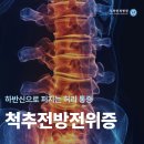 ＜김포신경외과＞ 허리 통증, 심해진다면? 이미지