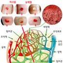 생노병사의 근원 체내 림프 다스리기 이미지