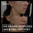 이피부과 - 노원구 한글비석로 474 | 줄기세포 피부재생주사 효과 있을까? 청담동 피부과 압구정 피부과 내돈내산후기