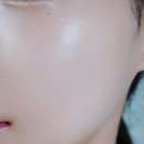 P-5C19 | 로에비타 멜라이트 비타민 3종 비타민앰플, 여름 기미와 광채 둘 다 잡은 후기
