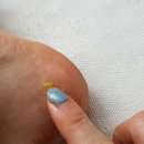 온메디케어 이미지