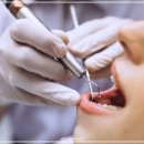 좋은솜씨죽전치과의원 | 수지치과 추천 후기 가격? 이 3가지만 보시면 됩니다