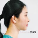 [촌철지압] ‘완골혈’ -두통, 경항통(목 아픔), 안구 불편감 등 이미지