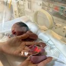 씨유 안암행복점 | 33w2d 조기양막파수 / 응급제왕수술후기 / 물섭취, 가스배출 / 고대안암병원 홍순철교수님