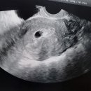 새란산부인과의원 이미지