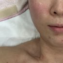 신수민 스킨케어 | 문래피부관리 신수민스킨케어에서 관리를 넘어 치료받고 온 후기