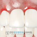 천안중앙플란트치과