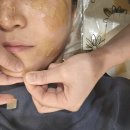 수영로 711 복합건물 | 대연동 피부관리 트랜스포머 오로라 색소관리 받은 &#39;제니룸스킨위드바디&#39;후기
