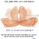 건강에 좋은 발끝 부딪치기 이미지