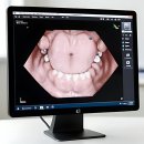 밝은365약국 | 홍제365치과의원에서 덧니 컴플렉스 완전 해소한 후기 들려드릴게요