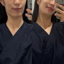 잠실피부관리 잠실새내역 근처 | 키웰 잠실점 샤이니 펌킨 대만족 후기
