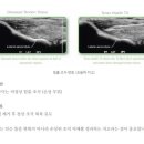 더힘의원 네이버블로그