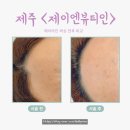 노형동주민센터 | [제주왁싱] 제주뷰티샵 노형동왁싱, 제이엔뷰티인