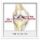 연골판파열의 치료, 관절내시경 이미지