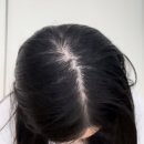 헤어토닉 닥터스시크릿 쿨링톡톡 버블 두피토닉 솔직후기