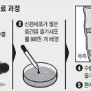 교통사고,척수손상,하반신,상반신 마비에 줄기세포치료의 길이 열려 올립니다. 이미지