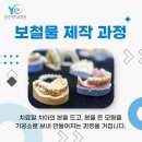 예치과기공소 이미지