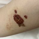 컴포트성형외과의원 이미지