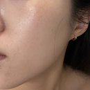 고원장의모공세척테라피 분당점 - 블랙헤드 고민으로 방문한 예신 분당피부관리 솔직후기