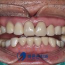 새로치과기공소 이미지