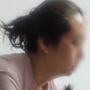 이중턱살 시술 소개팅주사 후기 | 더웨이성형외과에서 받은 솔직한 변화