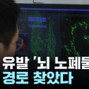 치매 유발 '뇌 노폐물' 배출 경로 찾았다!...치료제 개발 가능성 / YTN 이미지