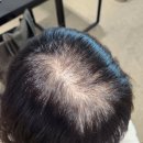 클라운지경남양산 - 양산시 백호로 64 | [내돈내산] 경주,울산두피문신 잘하는 곳 추천 "헤드라인유울산점"