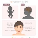 하이 알콜