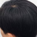 김호증모가발대구체인헤어슈