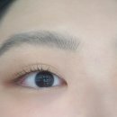 네일 인(Nail iN)