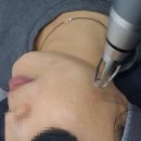 미그리다