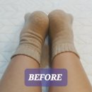 공덕 시티하우스 | 공덕역 체형 교정 거북목 라운드숄더 고친 웰카이로모션