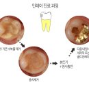 CS치과기공소 네이버블로그