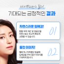 키스미쁘띠의원 네이버블로그