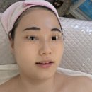 석관동제2경로당 | 석관동피부샵 추천 올가드림뷰티 돌곶이점 재생케어 후기
