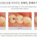 고운치과의원 - 은평구 통일로87길 6 | 고운치과의원