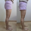 더휴스킨바디케어 | 대전바디관리 잘하는 "더휴스킨바디케어" 하체관리 후기
