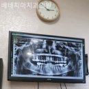 베네치아치과의원 네이버블로그