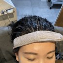대일빌딩 | 지루성 두피 고민 끝🧴 둔산동 웰킨두피센터 파워스케일링 리얼 후기!