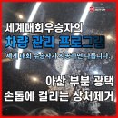 시글 | 아산 부분 광택의 기적, 쏘렌토 본넷 딥스크래치 완벽 복원 후기