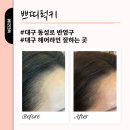 쁘띠헤어 | 대구 동성로 헤어라인 반영구 잘하는 쁘띠럭키 솔직후기