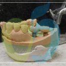 마이플란트치과기공소 이미지