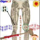 다리가 차고 붓고 차가운 이유 이미지