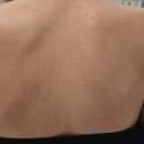 팔거천동로 | 동천동 MS에스테틱에서 신부관리 받아야하는 이유 | 등여드름 바디 케어 생체전류테라피 바이오필링 후기