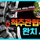 【환자사례】 허리, 엉덩이 통증, 다리저림 이미지