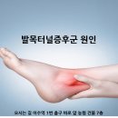 방배이수정형외과 발목터널증후군 알아보기 이미지