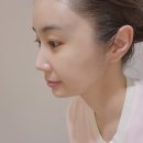 신길동 에스테틱 헤피h&amp;s피부관리샵 림프순환관리 후기