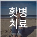 대전홧병 두근거림 불안 초조 여러 증상이 나타나요