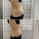 에스체형관리 | '통증 없이 슬림해질 수 있을까? 의정부 호원동 에스뷰티샵 체형관리 리얼후기'